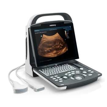 Самый дешевый портативный цифровой 2D 3d 4d акушерский гинекологический ультразвуковой сканер для ноутбука
